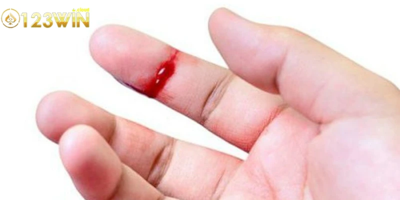 Các tình huống khác nhau có thể xảy ra khi mơ thấy máu